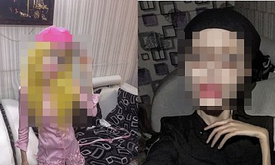 Ta dziewczyna ma 21 lat i ponad 50 operacji plastycznych za sobą. Chciała wyglądać jak Angelina Jolie, stała się potworem