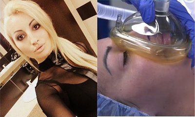 Jola Rutowicz zrobiła operację plastyczną nosa przed kamerami. Zdjęcia mrożą krew w żyłach!