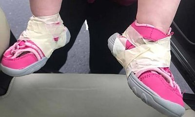 Mama dostała szału, gdy panie w żłobku ciasno obwiązały taśmą buciki jej dziecka