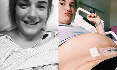 Mama pokazuje całą prawdę o cesarskim cięciu. Kobiety jej dziękują, a inne nazywają to ,,wydobycinami"