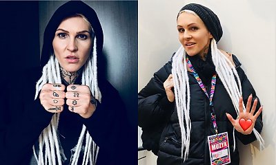 Agnieszka Chylińska przesadziła? Nie uwierzycie, co zrobiła ze swoją twarzą. Nie każdemu się to podoba!