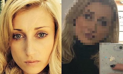 Justyna Żyła ingerowała w rysy twarzy. Wypłynęły zdjęcia ,,przed i po", które zdradzają wszystko