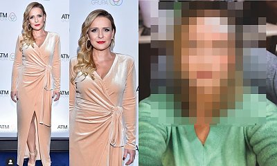 Posiniaczona Aneta Zając opublikowała drastyczne zdjęcia. Co się stało? Jak do tego doszło? Wyznała prawdę!