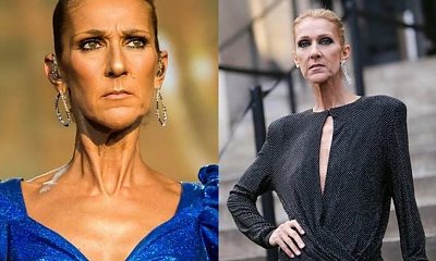 Gwiazdy, które przesadziły z odchudzaniem. Te zdjęcia pokazują prawdę