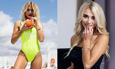 Beata Grucela z "Love Island" miała wypadek! Pokazała wstrząsające obrażenia twarzy. "Wyglądam jak Frankenstein"
