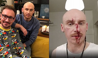 Ktoś pobił Jacka Szawiołę z "Gogglebox" na ulicy. "Tak wygląda wolność w naszym kraju"