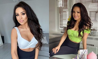 Sylwia Bomba otwarcie o operacjach plastycznych. Gwiazda "Gogglebox" majstrowała przy twarzy?