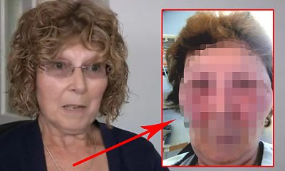 63-latka omal nie zmarła po tym, co wstrzyknięto jej w twarz. Zdjęcie tuż po zabiegu przeraża!