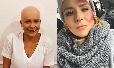 Aneta Zając cała we krwi: "Myślałam, że to na Halloween" - pisze fanka. Nic z tych rzeczy!