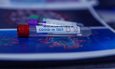 Czy to był Covid-19, czy zwykła infekcja? Wszystko o testach na przeciwciała anty-SARS-CoV-2