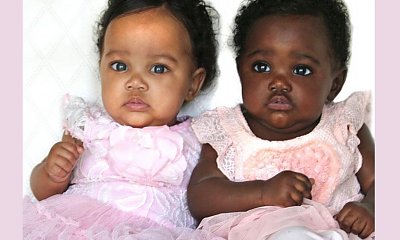 Bliźniaczki o różnych kolorach skóry oczarowały internautów. Zobaczcie, jak wyglądają dziś niezwykłe siostry!