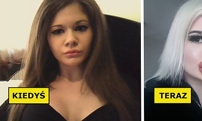 Andrea Ivanova jest posiadaczką największych ust na świecie! "Żywa Barbie" powiększała je aż 22 razy!