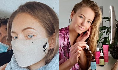 Agata Rubik DRASTYCZNIE powiększyła usta? "Jak taka żaba albo glonojad" - oceniają fani