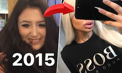 W wieku 13 powiększyła usta. Zoperowała nos, a marzy o usunięciu żeber. Chce być jak Barbie!