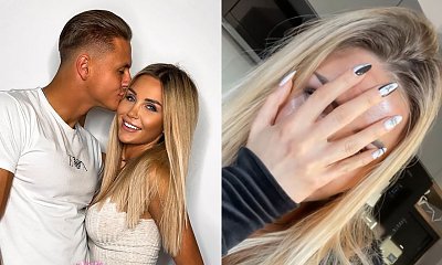 Angela Dańczak z "Love Island" pokazała, jak wygląda jej twarz po kwasach! Drastyczne zdjęcia! "Wyglądasz na 35 lat" - piszą