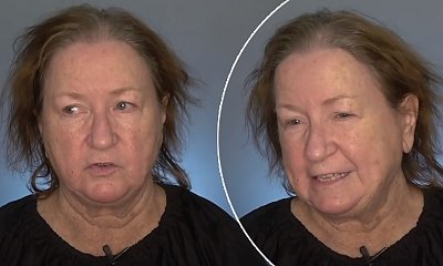 67-latka przez lata nosiła peruki. Metamorfoza jej cienkich włosów jest powalająca