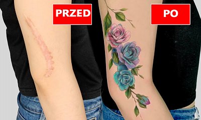 16 przepięknych tatuaży, które zakrywają blizny i niedoskonałości. Małe dzieła sztuki!