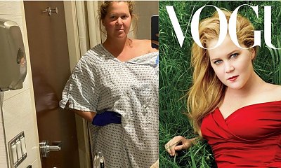 Amy Schumer usunęła macicę! Choruje na poważną chorobę...