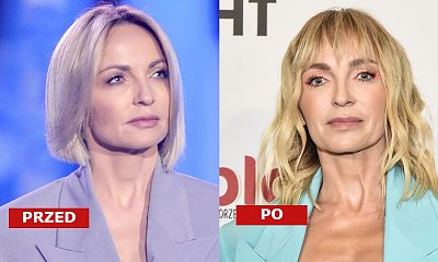 Anna Wyszkoni i jej nowa twarz na Flesz Fashion Night. "Czy ona przeszła przeszczep twarzy?" - pytają brutalnie internauci