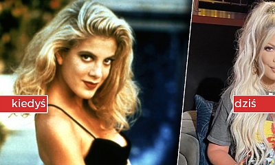 Fani zaniepokojeni nową twarzą Tori Spelling. "Przecież nie przypominasz już siebie... Dramat!" - piszą internauci