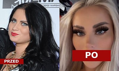 Ewelina Kubiak po raz kolejny powiększyła usta! Pokazała efekt! "Morda jak Predator" - piszą okrutnie internauci