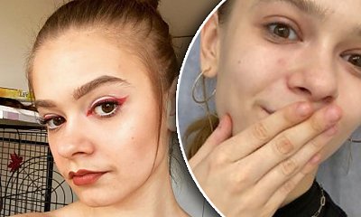 22-letnia Julia Wróblewska powiększyła usta! "Ale opuchłam" - napisała młoda aktorka