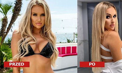 Aleksandra Stręk z "Love Island" powiększyła piersi! Ogromna metamorfoza! Pokazała zdjęcia "przed" i "po"