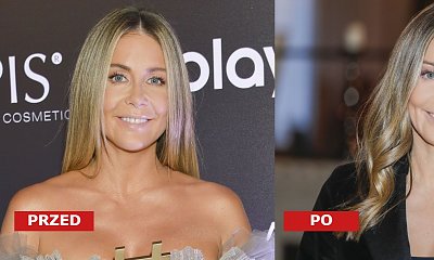 Małgorzata Rozenek na konferencji fundacji z "nową twarzą"! Internauci: "Źle to wyszło! Jak Grinch"