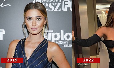Jessica Ziółek ma "nową twarz"! Co za metamorfoza! Porównujemy zdjęcia "przed" i "po"