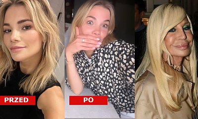 Maja Bohosiewicz powiększyła usta w Polsce! "Wyglądam jak Donatella Versace". Faktycznie?