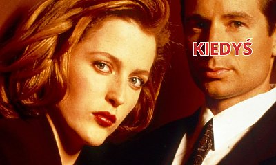 Gillian Anderson z nową twarzą na ściance. Coś chyba poszło nie tak... Jest zbyt gładko?