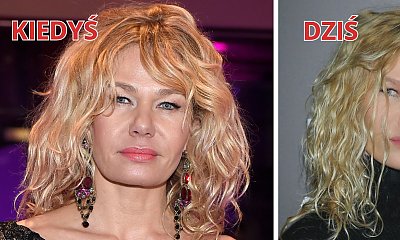 Katarzyna Wołejnio z "Żon Hollywood" wróciła! Co się stało z jej twarzą? "Kobieta-kot"?
