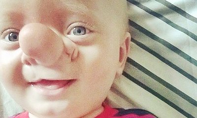 Śmiali się z noska jej synka. Nazywali go Pinokiem i dokuczali mu. Dziś jest nie do poznania!