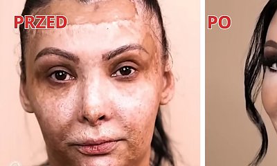 Szokująca metamorfoza 45-latki z bliznami - nie uwierzysz, jak bardzo odmienił ją makijaż!