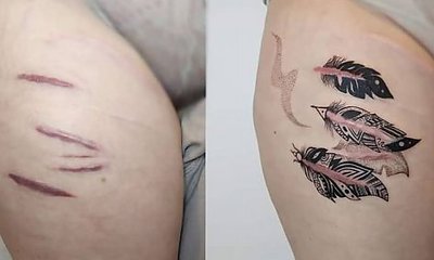 Tatuaż na bliźnie: dodaje odwagi, pewności siebie i piękna! Zobacz spektakularne metamorfozy!