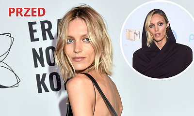 Anja Rubik wróciła na salony! Fani zaniepokojeni jej twarzą na finale "Top Model". "Dziwny kształt"