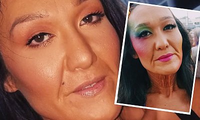 31-latka ma skórę starszej osoby. Ludzie się z niej śmieją, a ona dumnie prezentuje swoje wdzięki