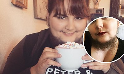 Od 8 lat nie goli brody i w końcu jest szczęśliwa! Internauci są jednak dla niej bezwzględni