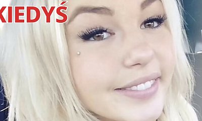 Ta kobieta wydała ponad milion złotych, by upodobnić się do... smoka! Zobacz, jak wygląda teraz!