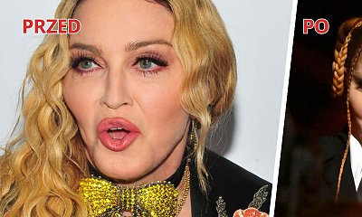 Madonna z "napompowaną" twarzą na Grammy 2023! "Kim jest ta dziewczyna?!" - pytają zaniepokojeni internauci