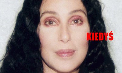 Cher zaczyna coraz bardziej przypominać Michaela Jacksona? Jej twarz wygląda niepokojąco!