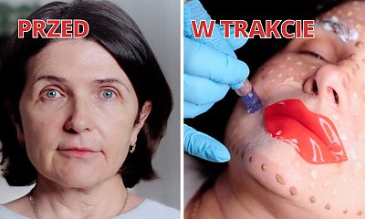 "Mój o 5 lat młodszy mąż zabronił mi się starzeć. Pewna wiadomość zwaliła mnie z nóg. Przeszłam sporą metamorfozę"