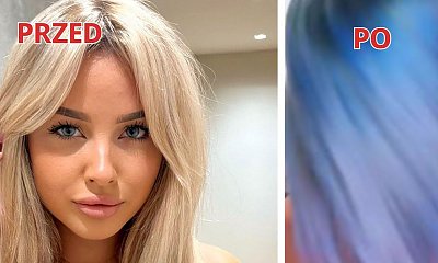 22-letnia Oliwia z "Love Island" ma nowe zęby i niebieskie włosy! Zdradziła, ile za to zapłaciła
