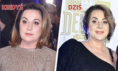 Odchudzona Danuta Martyniuk po operacji plastycznej z nową twarzą na salonach! Efekt piorunujący!