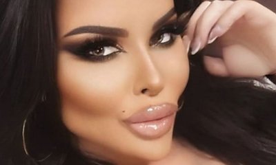 Esmeralda Godlewska znów poprawiła urodę. Tym razem zrobiła sobie w Turcji nowe zęby