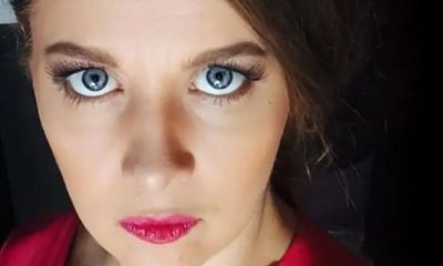 Anna Powierza z siniakami po zabiegach upiększających. Ktoś pisze: "Sporo bólu w tych oczach"