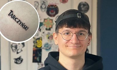 Ten Polak wytatuował sobie kilkanaście logo firm, by dostać od nich prezenty. Chyba nie na takie liczył...