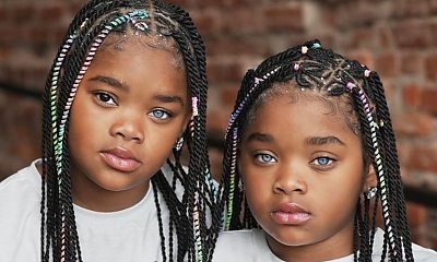 Ta para bliźniaczek jest jedną z 20 najbardziej wyjątkowych na świecie! Wszystko przez ich oczy!