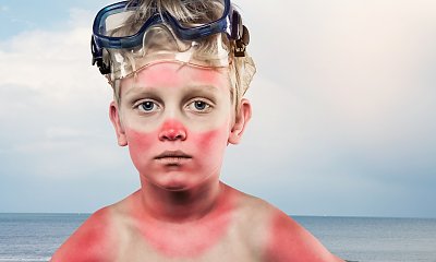 "Zaniemówiłam, kiedy zobaczyłam mojego synka po powrocie z wakacji z dziadkami. Czy moi teściowie mają za grosz odpowiedzialności?! W głowie się nie mieści!"