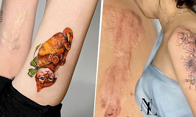 Tatuaż na bliznach - pożegnaj się z trudną przeszłością i odkryj swoje naturalne piękno